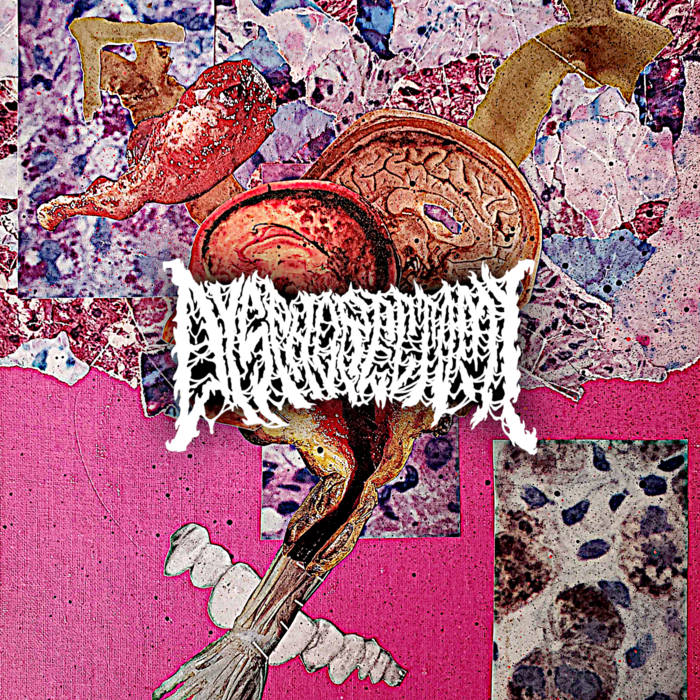 Dysphorectomy - Remnants