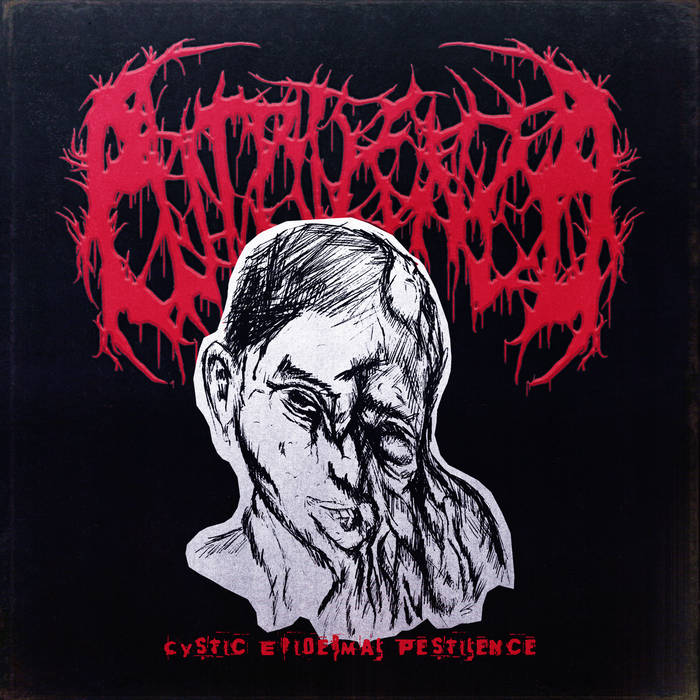 Putrilence - Cystic Epidermal Perstilence